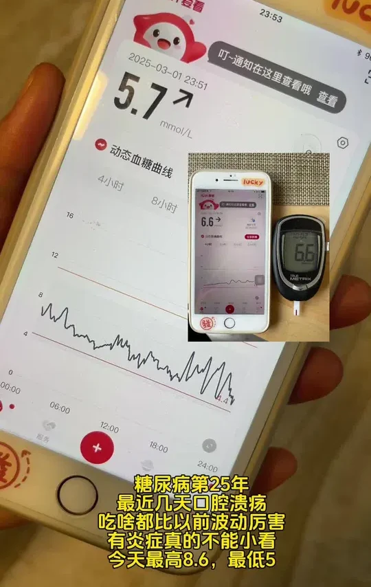 手抓饼是真的稳 #糖友 #动态血糖