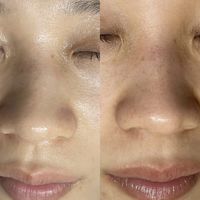 补水面膜排行榜第一名，2025补水面膜排行榜，10强品牌公布