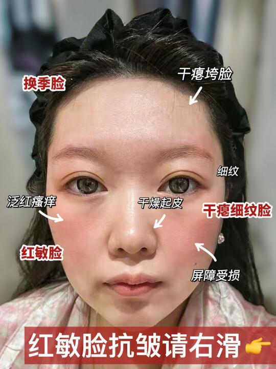 换季红脸仙品！敏肌有了抗皱破局之法！