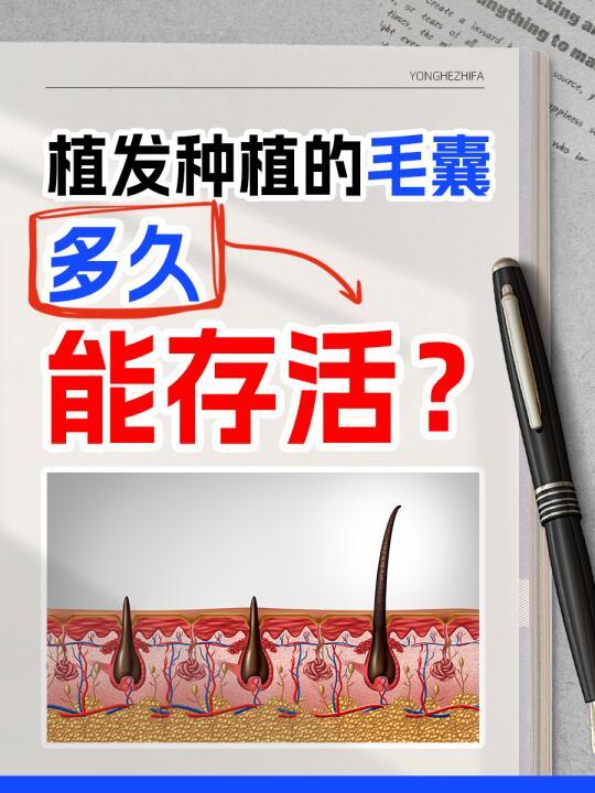 🌱植发后的毛囊“扎根”时间表