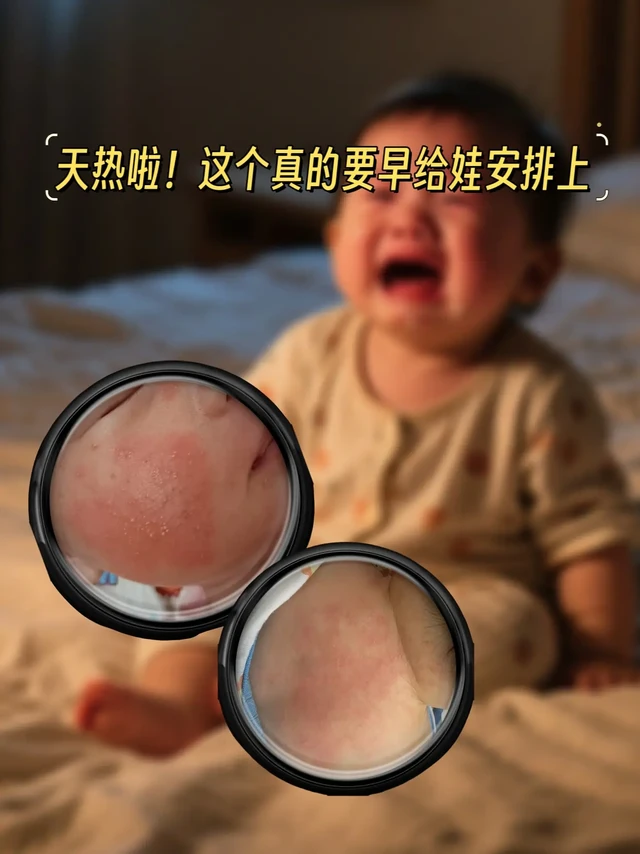 被低估的宝宝金水，后悔没早给娃准备。当妈之后，每到夏天都像开启“战斗模式”！宝宝娇嫩的皮肤，稍不注意就被痱子、蚊虫盯上，红一片、痒得直哭，当家长的看着超心疼！最近翻到童年回忆“宝宝金水”，抱着试试的心