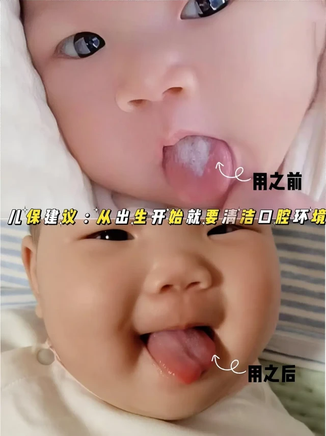 儿保建议:宝宝口腔定期清理很重要!!宝宝口腔可以说是容纳细菌的“大本营”之一，你可别以为宝宝小，细菌就少了。
从出生开始就要给宝宝清洁口腔，不仅是为了他的口腔卫生，更是为了长远的刷牙习惯培养，毕竟好习