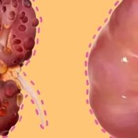 熬夜、过度劳累？这些伤肾行为=慢性自杀！