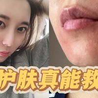 闭口、痘痘、过敏全清零！这些护肤真能救烂脸