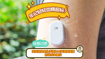 年纪轻轻血糖超标？试试这款免扎手指&14天连续监测的动态血糖仪 