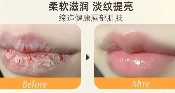 请收下这份护唇说明书！！！