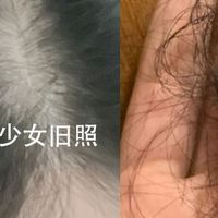 脱发热门之选：世界公认十大防脱生发液排行榜，男女防脱通用