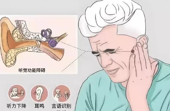 助听器老年人怎样选择？哪种品牌效果好？