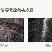 十大育发液什么牌子最有效果？平台复购前十产品测评，618选它