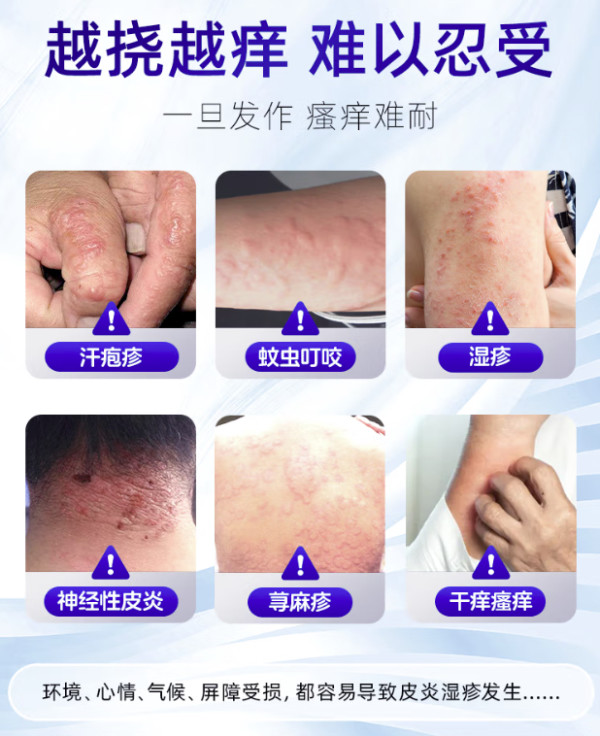 值选、值友专享、PLUS会员:延好 复方倍氯米松樟脑乳膏 30g
