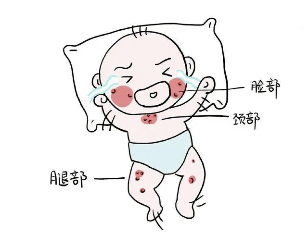 小满时节儿童健康养护全攻略:守护成长“小满”,远离疾病困扰