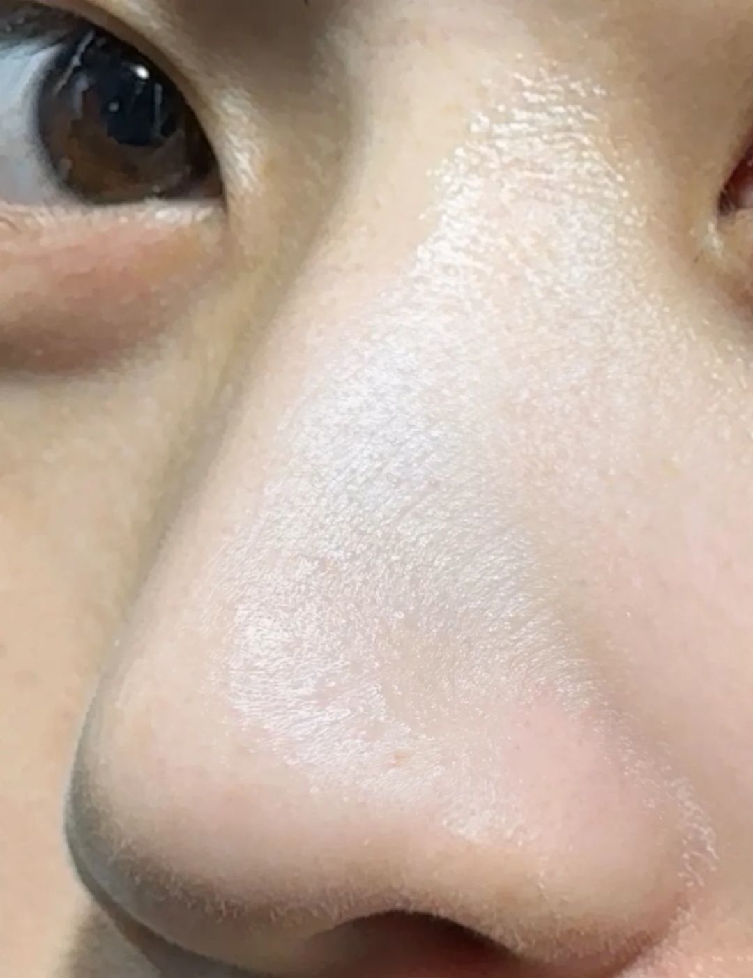 黑头清洁三大误区伤屏障!四步科学缩毛孔法告别草莓鼻,控油养护全攻略