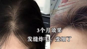 防脱发生发增发密发哪个牌子好？育发液十大品牌分享，有效安利
