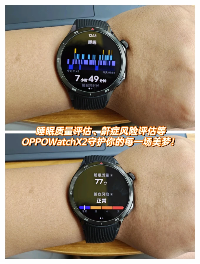 智能手表