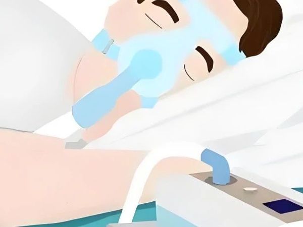 持续气道正压通气治疗（CPAP呼吸机治疗）注意事项