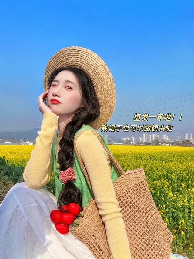 植发日记📓成功上岸植发满一年噜～