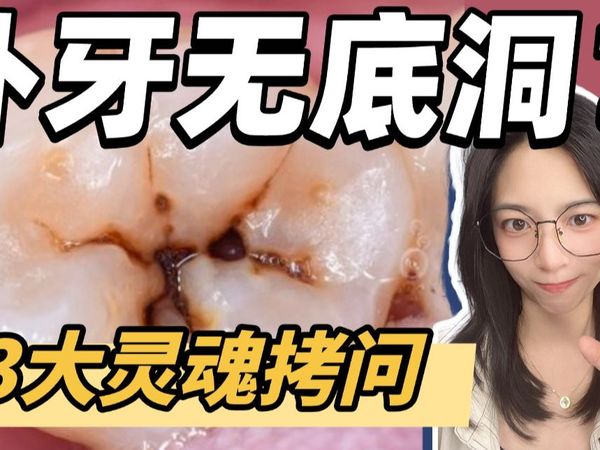 🦷补牙会反复？｜浅龋要不要管？
