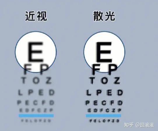散光有200想配隐形眼镜，用得着特意定制散光片吗?