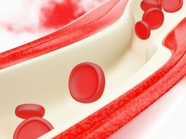 这种营养女性缺乏率是男性15倍，大多数人却不知道自己缺！