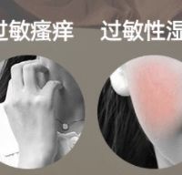 除螨仪什么牌子的好用？2025年口碑最好的6款除螨仪推荐！