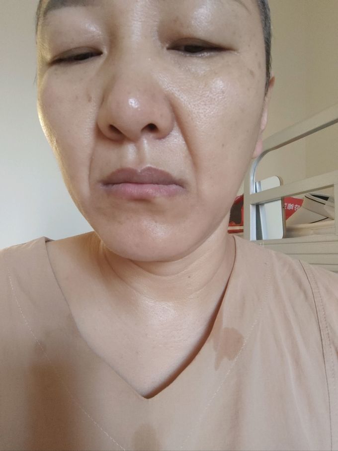 敷尔佳面部皮肤管理