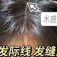 什么防脱产品效果好？世界公认有效防脱生发液分享，收藏top
