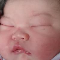 女子孕期狂吃水果花3W，剖腹产出生的宝宝，医生看后都不淡定了