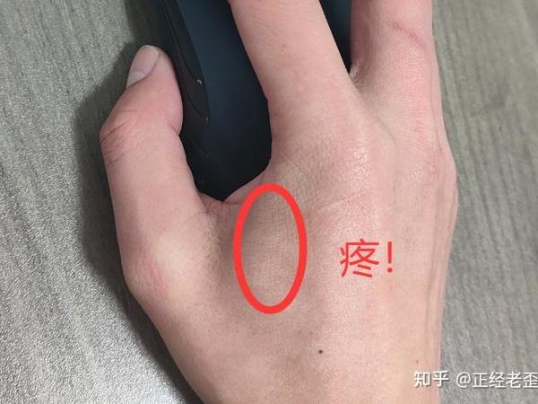 人体工程学鼠标到底有用没？2025有什么推荐？对比亲测