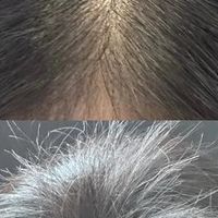 公认有效防脱生发，正规防脱产品前十，养发稳了！