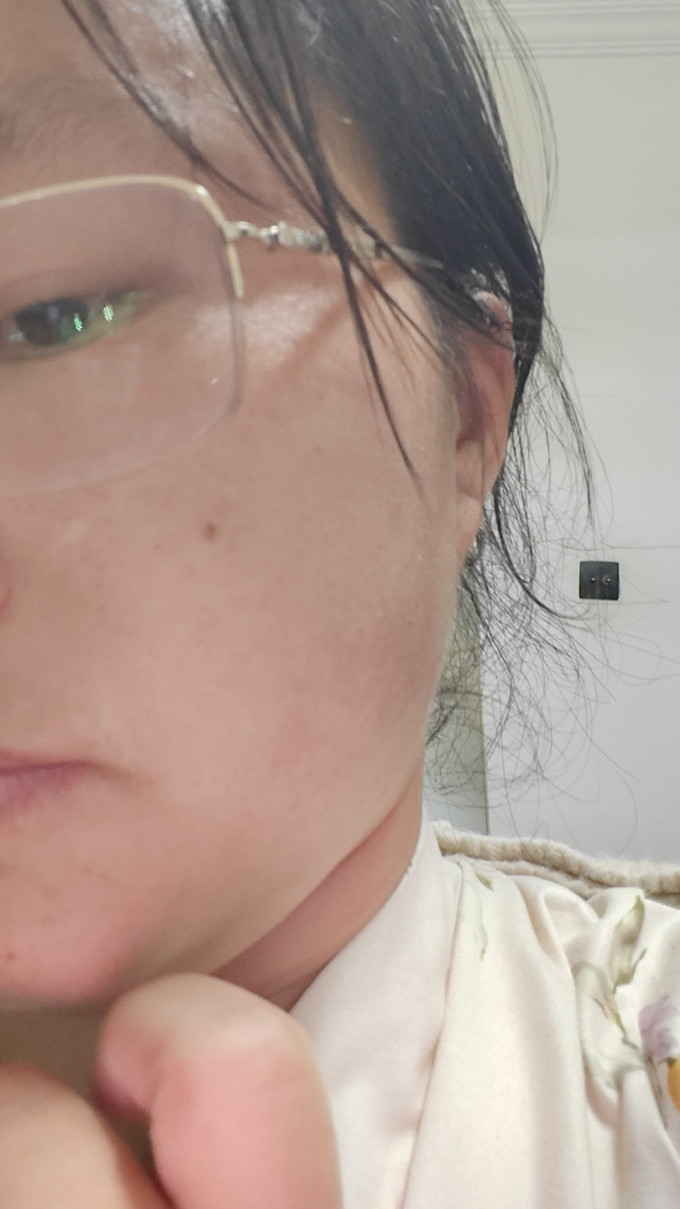 敷尔佳精华原液