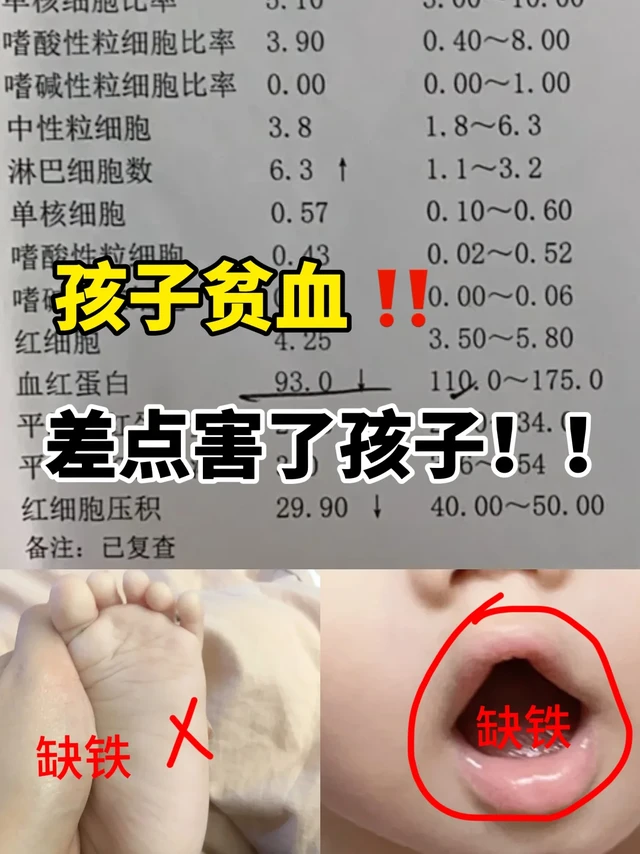 都怪我太大意了，宝宝居然贫血了😭