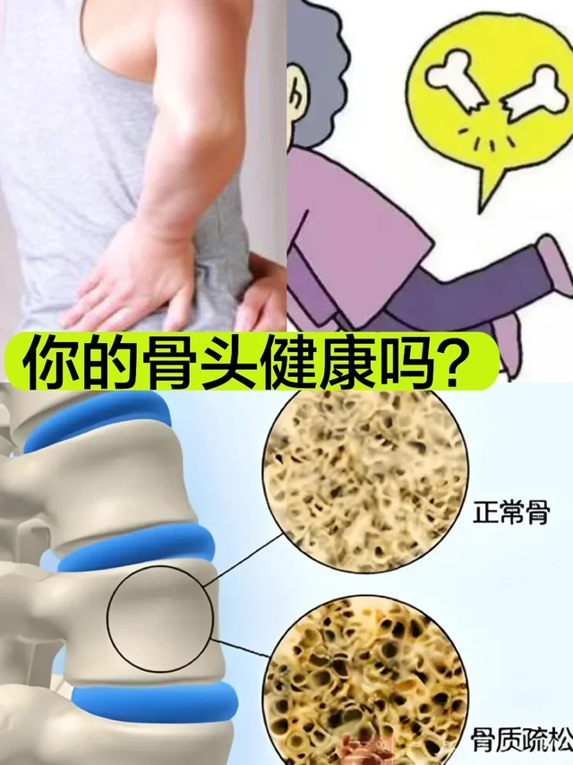 你的骨头健康吗？骨骼营养补对了吗？
