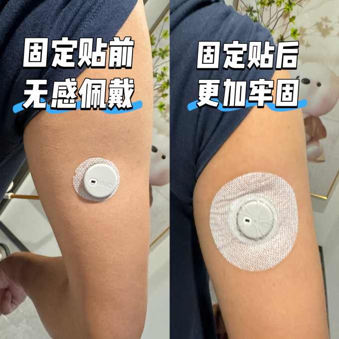 血糖仪