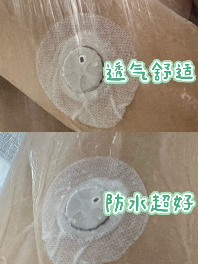 血糖仪