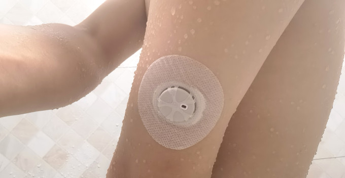 血糖仪