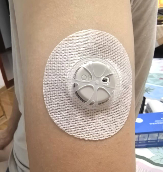 血糖仪