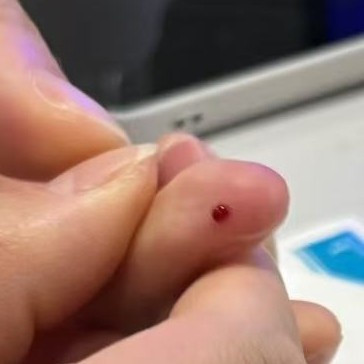 血糖仪使用感受