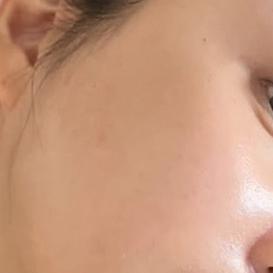 Erty：成为你的肌肤“急救包”