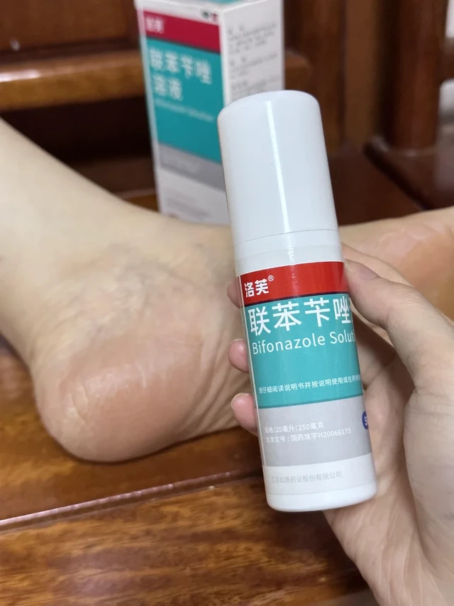 这下角化型脚气真的不会出来刷存在感了