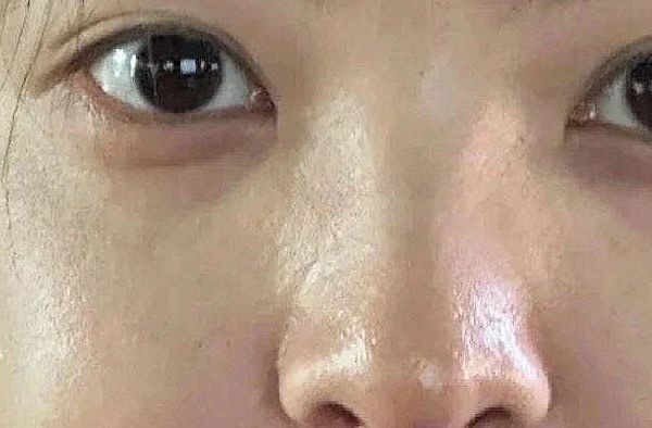 一些有效收缩毛孔的方法，很多人都不知道