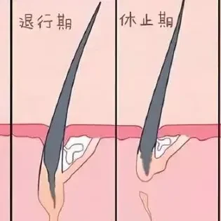 十肽-18，wnt10的一种衍生肽，刺激头皮毛囊，长出新生头发