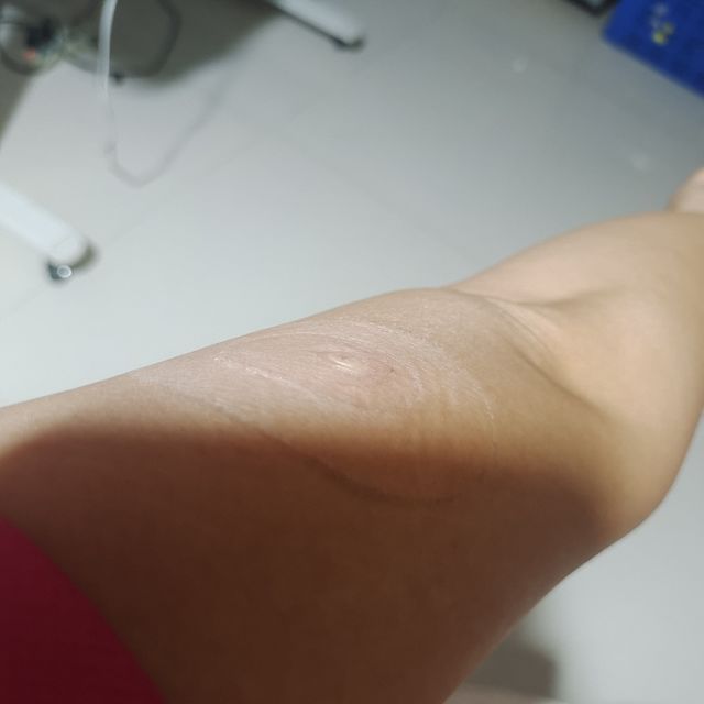 动态血糖仪的血糖报告能能够看到什么？完整佩戴14天后的感受