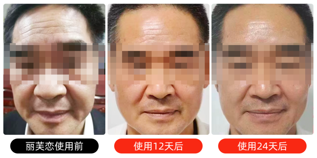 14面部打码3.png
