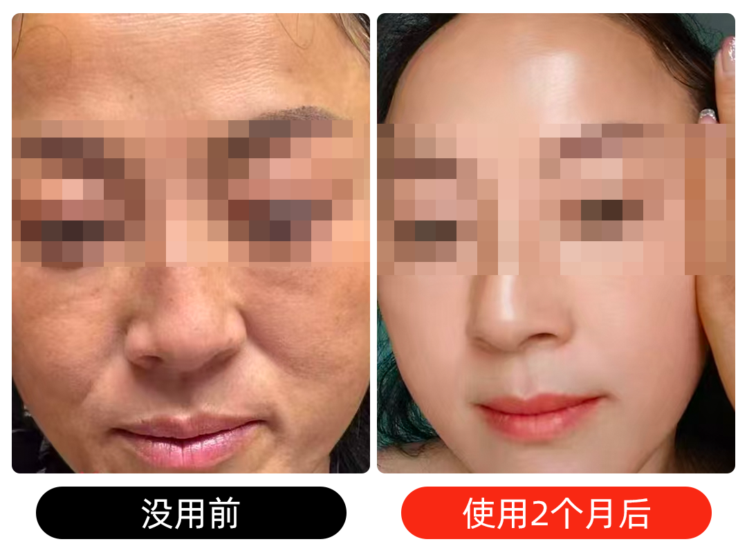 13面部打码2.png