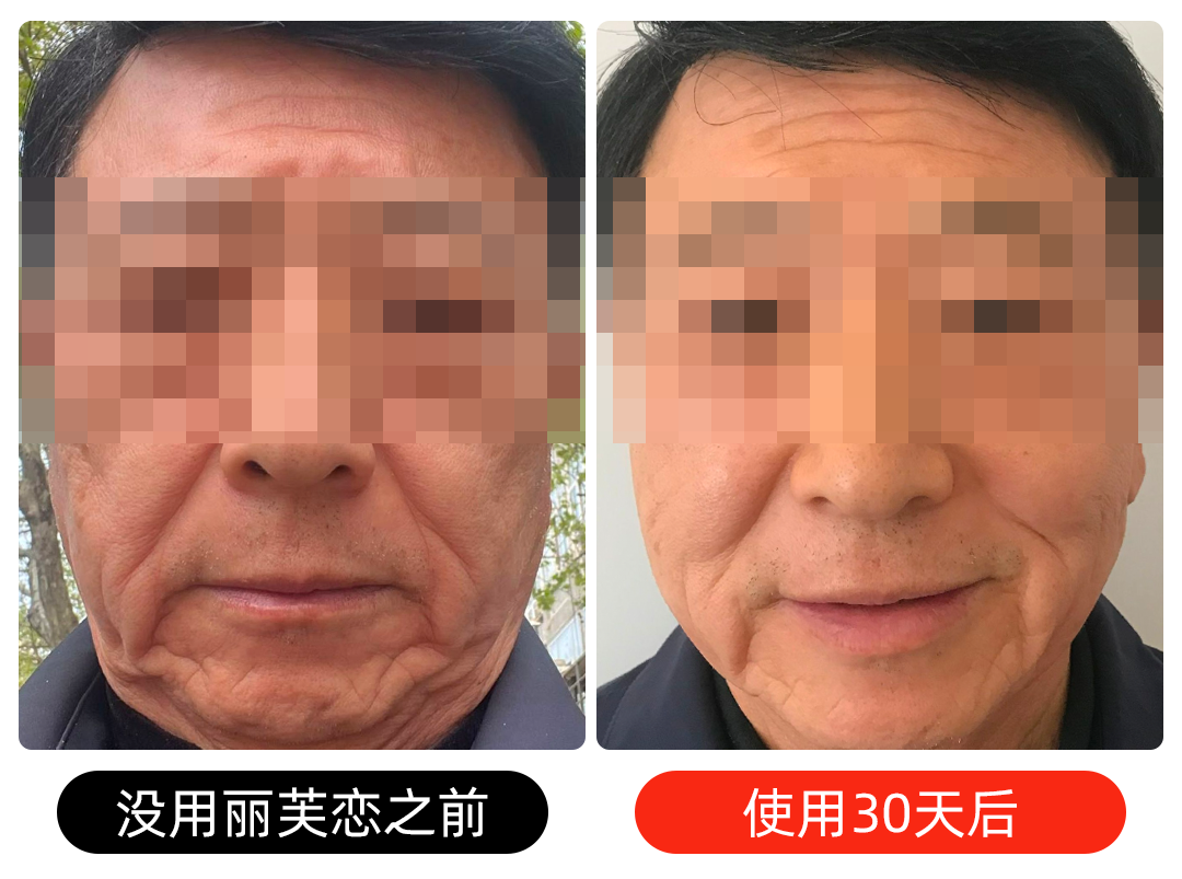 16面部打码5.png