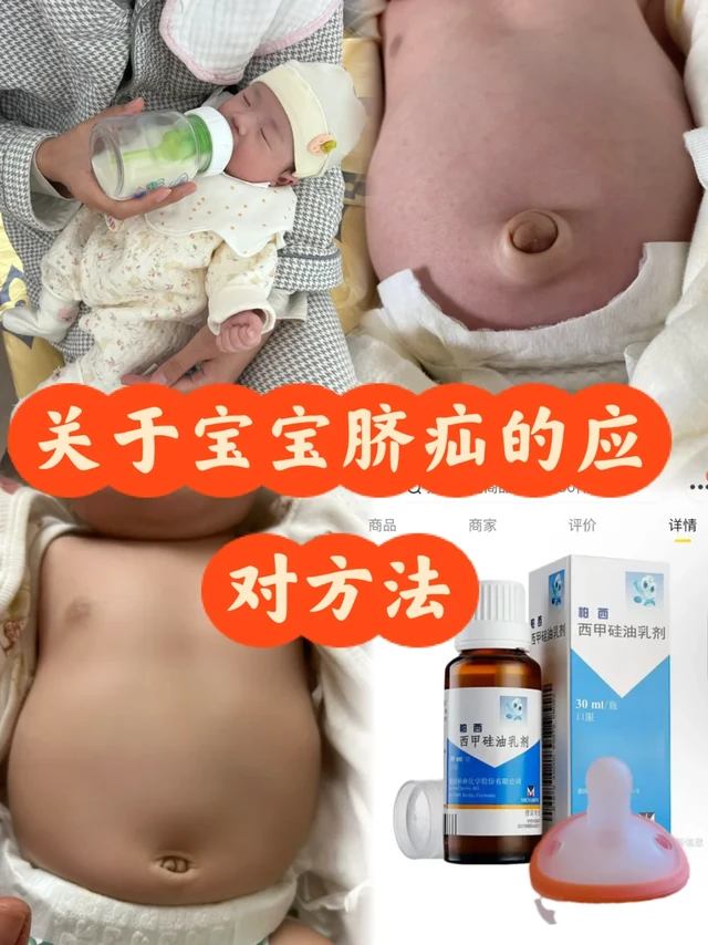 护士妈妈护理宝宝脐疝｜2️⃣周速成攻略👍
