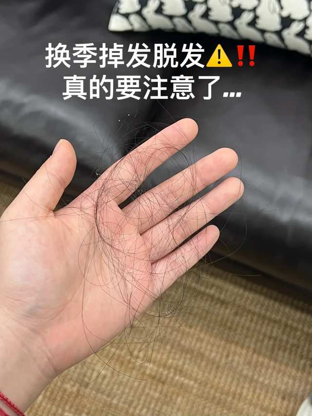 换季脱发掉发，你需要注意⚠️