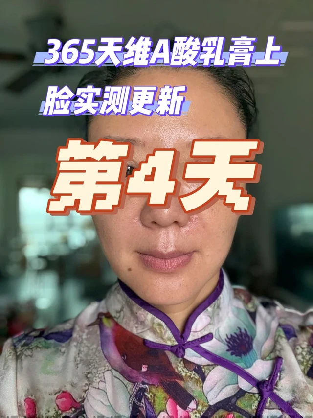 365天维A酸乳膏上脸实测每天更新（第4天）