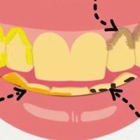 牙齿发黄的原因有哪些？牙齿变白的方法！想白牙照着做！