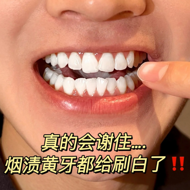 不到30的小玩意，陈年烟渍老黄牙都刷白了！！！